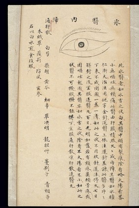 Illustration from Ming Chinese ophthalmology text, Ms copy