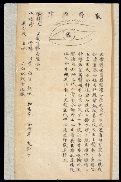 Illustration from Ming Chinese ophthalmology text, Ms copy