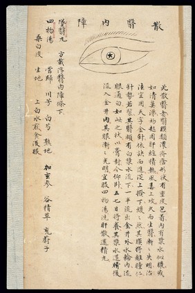 Illustration from Ming Chinese ophthalmology text, Ms copy