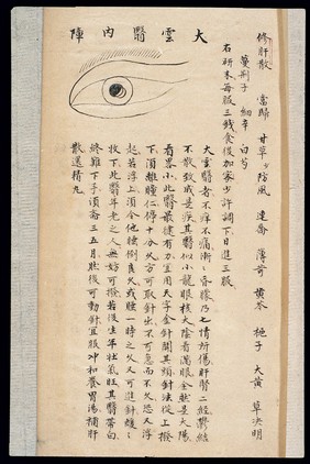 Illustration from Ming Chinese ophthalmology text, Ms copy