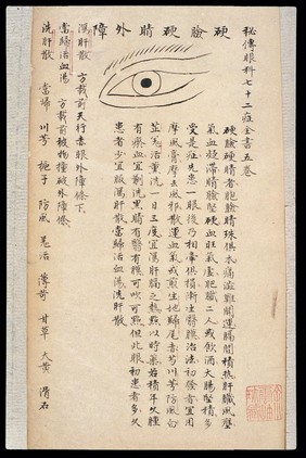 Illustration from Ming Chinese ophthalmology text, Ms copy