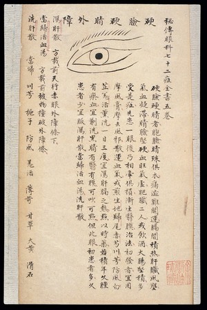 view Illustration from Ming Chinese ophthalmology text, Ms copy