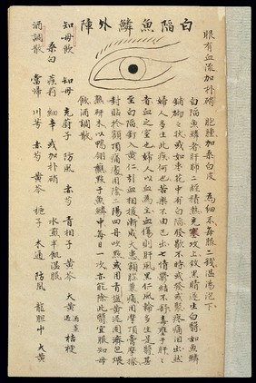 Illustration from Ming Chinese ophthalmology text, Ms copy