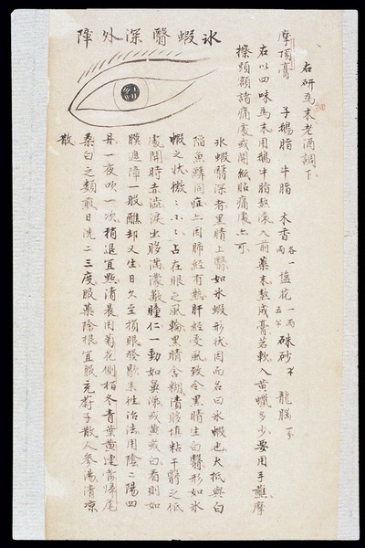 Illustration from Ming Chinese ophthalmology text, Ms copy
