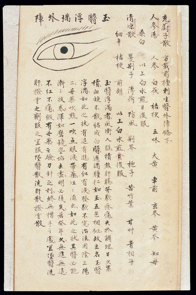 Illustration from Ming Chinese ophthalmology text, Ms copy