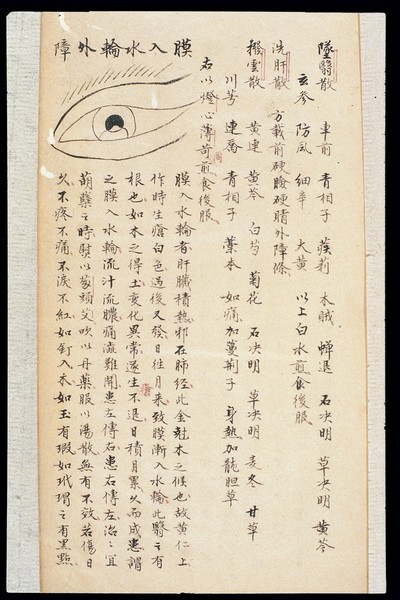 Illustration from Ming Chinese ophthalmology text, Ms copy