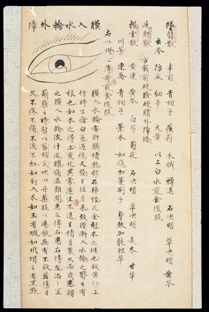 view Illustration from Ming Chinese ophthalmology text, Ms copy