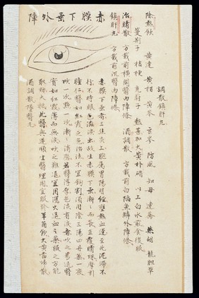 Illustration from Ming Chinese ophthalmology text, Ms copy