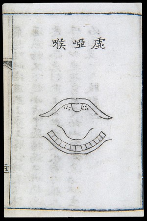 view C18 Chinese woodcut: Deficiency-type hoarseness