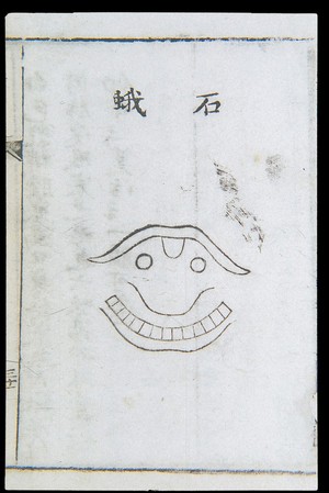 view C18 Chinese woodcut: Stony tonsillitis