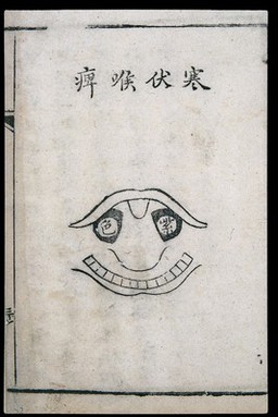C18 Chinese woodcut: Lurking-cold pharyngitis