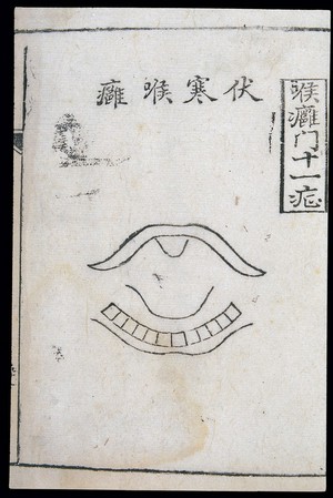 view C18 Chinese woodcut: Lurking-cold throat abscess