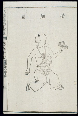 view Chinese C18: Paediatric pox - 'Gathered on the Breast' pox