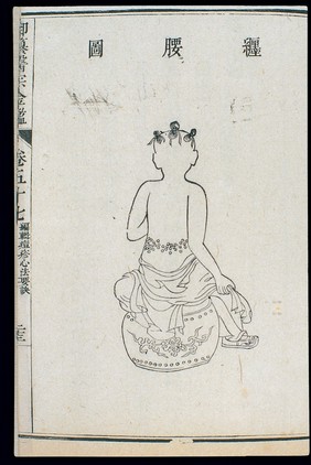 Chinese C18: Paediatric pox - 'Waist Entwining' pox