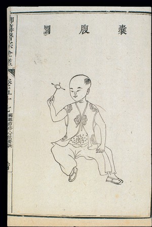 view Chinese C18: Paediatric pox - 'Belly Vescicles' pox