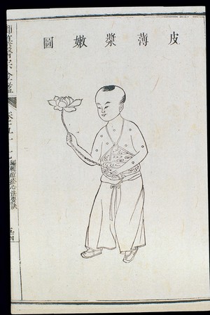 view Chinese C18: Paediatric pox - 'Thin skin and tender pulp'