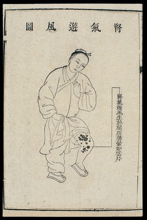 view Chinese C18 woodcut: External medicine - 'Wandering wind'