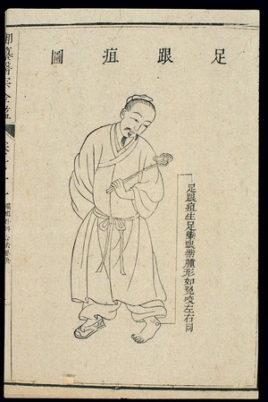 view Chinese C18 woodcut: External medicine - Ulcer on the heel