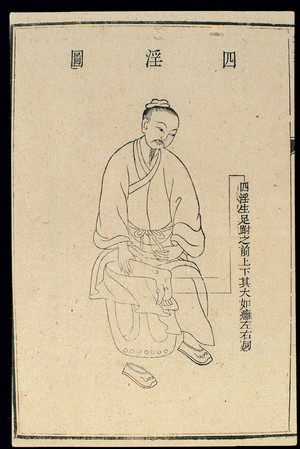 view Chinese C18 woodcut: External medicine - Siyin ulcer