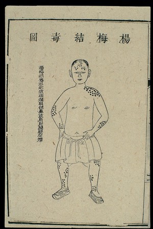 view Chinese C18 woodcut: External medicine - syphilitic sores