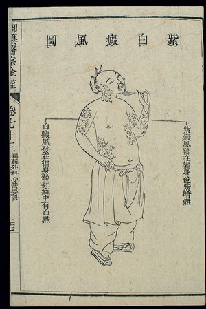 view Chinese C18 woodcut: External medicine - Vitiligo