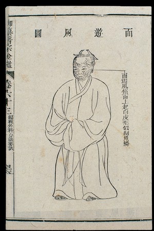 view Chinese C18 woodcut: External medicine - Facial dermatitis