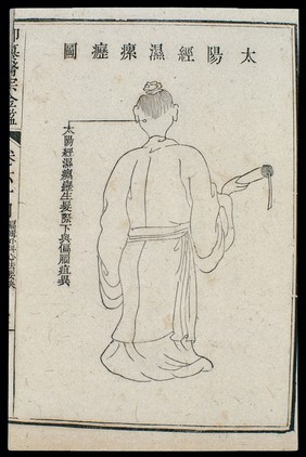 Chinese C18 woodcut: External medicine - Scrofula