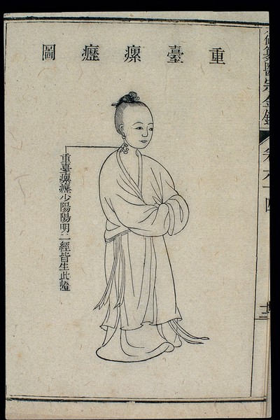 Chinese C18 woodcut: External medicine - Scrofula