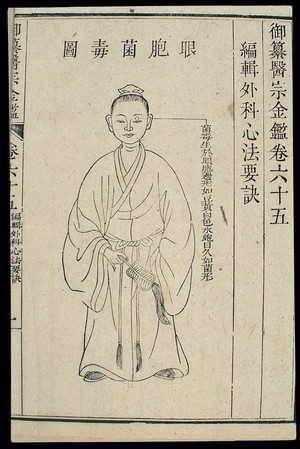 view Chinese C18 woodcut: External eye - Infected eyelids