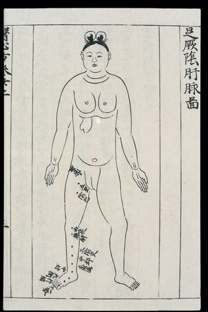 view Acupuncture prohibitions for pregnancy, Chinese/Japanese