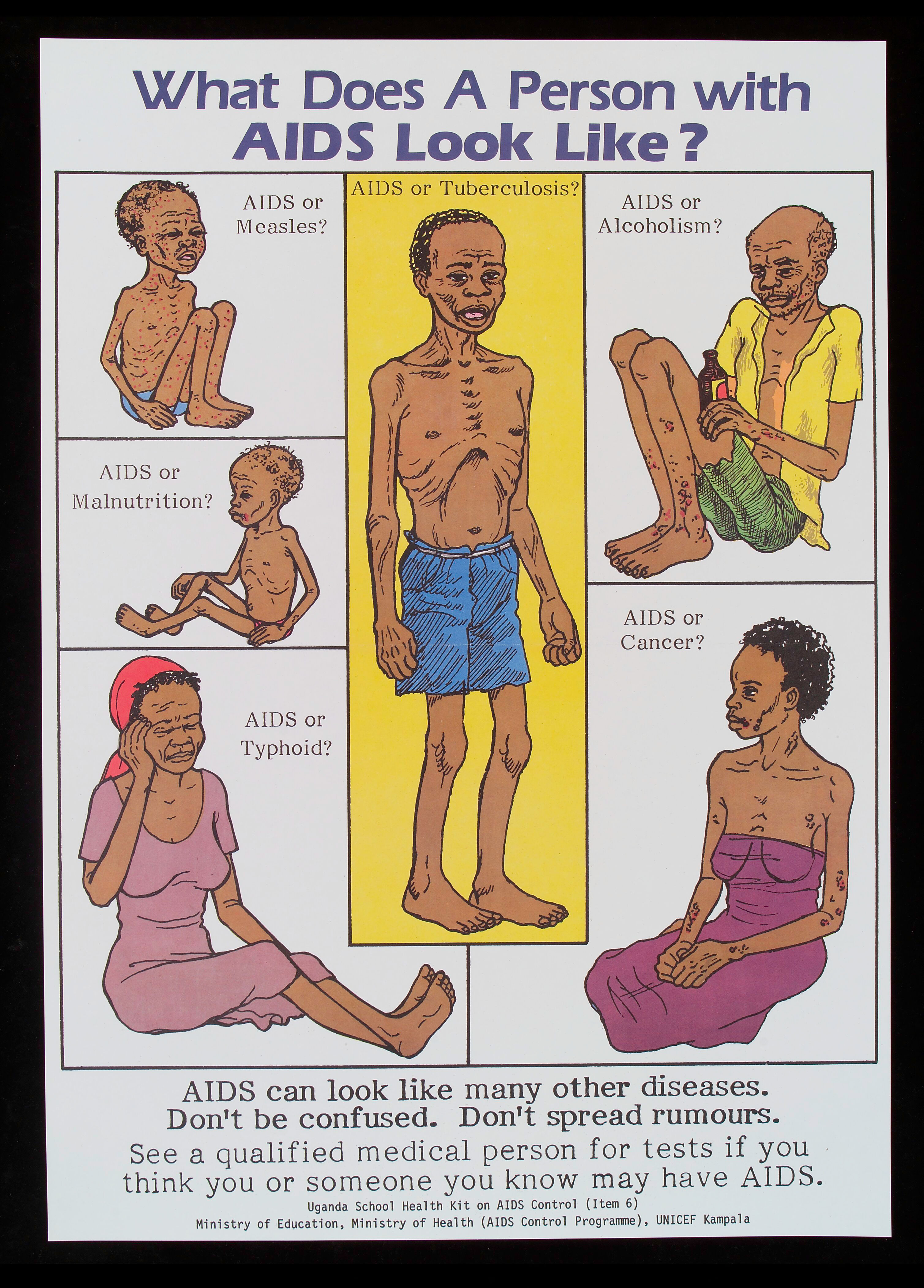Six Ill People, With Either Aids Or Another Disease, Representing The  Difficulty Of Being Sure That Someone Has Aids. | Wellcome Collection