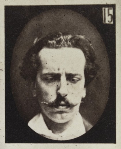 Mécanisme de la physionomie humaine, ou, Analyse électro-physiologique de l'expression des passions / [Guillaume Benjamin Amand Duchenne].
