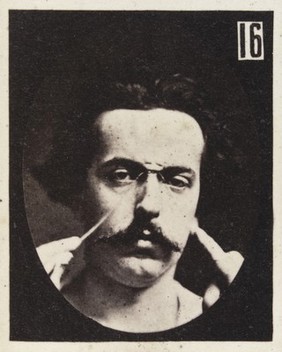 Mécanisme de la physionomie humaine, ou, Analyse électro-physiologique de l'expression des passions / [Guillaume Benjamin Amand Duchenne].