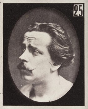 Mécanisme de la physionomie humaine, ou, Analyse électro-physiologique de l'expression des passions / [Guillaume Benjamin Amand Duchenne].