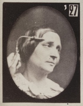 Mécanisme de la physionomie humaine, ou, Analyse électro-physiologique de l'expression des passions / [Guillaume Benjamin Amand Duchenne].