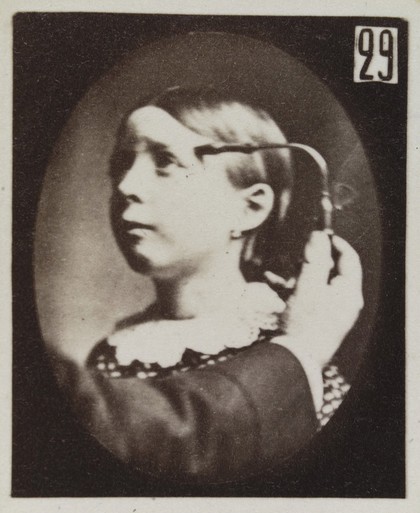 Mécanisme de la physionomie humaine, ou, Analyse électro-physiologique de l'expression des passions / [Guillaume Benjamin Amand Duchenne].