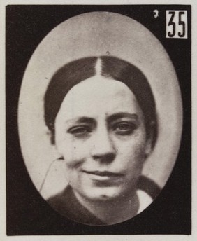 Mécanisme de la physionomie humaine, ou, Analyse électro-physiologique de l'expression des passions / [Guillaume Benjamin Amand Duchenne].