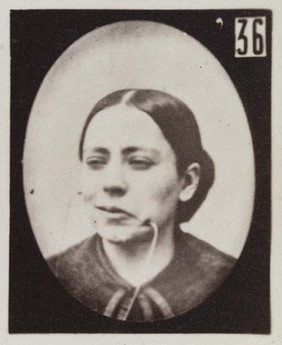 Mécanisme de la physionomie humaine, ou, Analyse électro-physiologique de l'expression des passions / [Guillaume Benjamin Amand Duchenne].