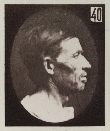 Mécanisme de la physionomie humaine, ou, Analyse électro-physiologique de l'expression des passions / [Guillaume Benjamin Amand Duchenne].