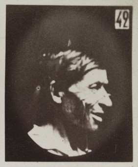 Mécanisme de la physionomie humaine, ou, Analyse électro-physiologique de l'expression des passions / [Guillaume Benjamin Amand Duchenne].