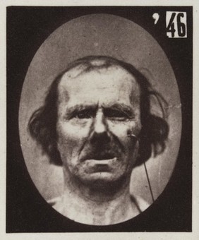 Mécanisme de la physionomie humaine, ou, Analyse électro-physiologique de l'expression des passions / [Guillaume Benjamin Amand Duchenne].