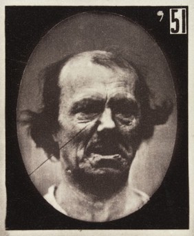 Mécanisme de la physionomie humaine, ou, Analyse électro-physiologique de l'expression des passions / [Guillaume Benjamin Amand Duchenne].