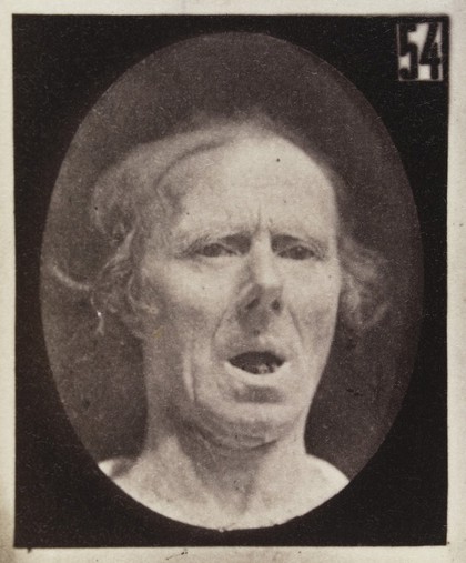 Mécanisme de la physionomie humaine, ou, Analyse électro-physiologique de l'expression des passions / [Guillaume Benjamin Amand Duchenne].
