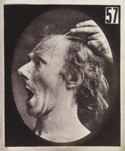 Experiments in physiology. Facial expressions; Amazement