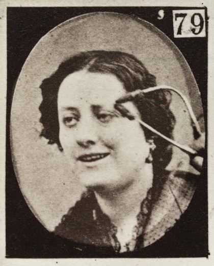 Mécanisme de la physionomie humaine, ou, Analyse électro-physiologique de l'expression des passions / [Guillaume Benjamin Amand Duchenne].