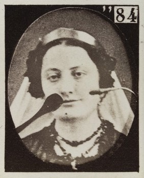 Mécanisme de la physionomie humaine, ou, Analyse électro-physiologique de l'expression des passions / [Guillaume Benjamin Amand Duchenne].