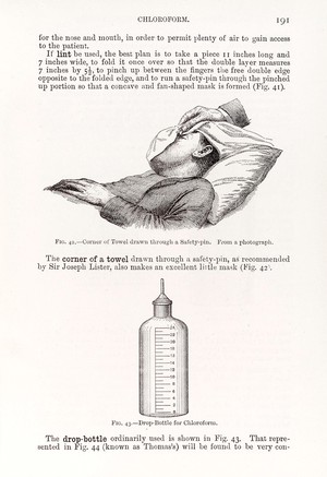 view Patient being given chloroform (T) Chloroform bottle (B)