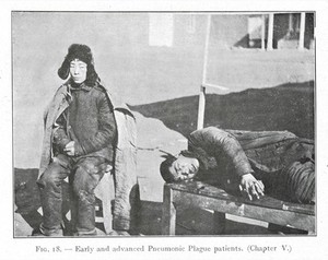 view Early and Advanced Pneumonic Plague patients