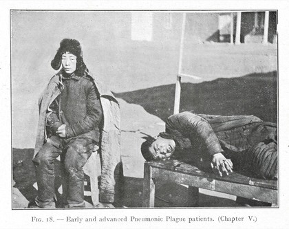 Early and Advanced Pneumonic Plague patients