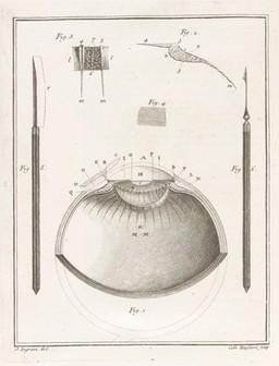 De cataracta. Theses ex anatomia et chirurgia ... / [Jacques Tenon].
